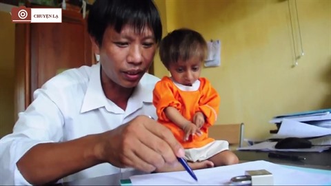 Un Cas De Nanisme A Tete D Oiseau A Quang Ngai Le Courrier Du Vietnam