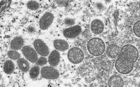 UK: Monkeypox is now a noticeable disease